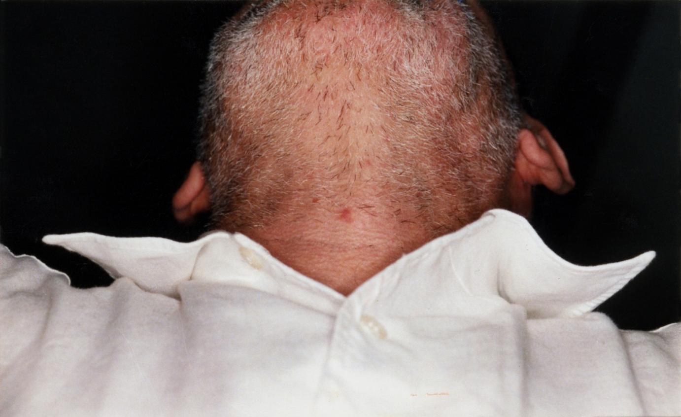 Sans titre, 1999-2003. Contre-plongée sur le menton d'un homme mal rasé.